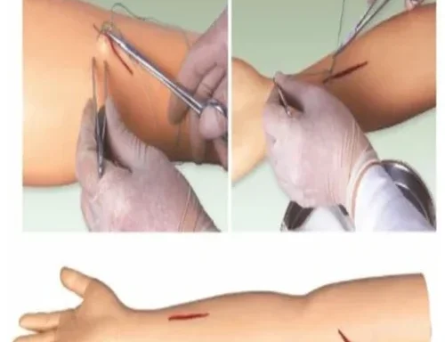Advanced Surgical Suture Arm