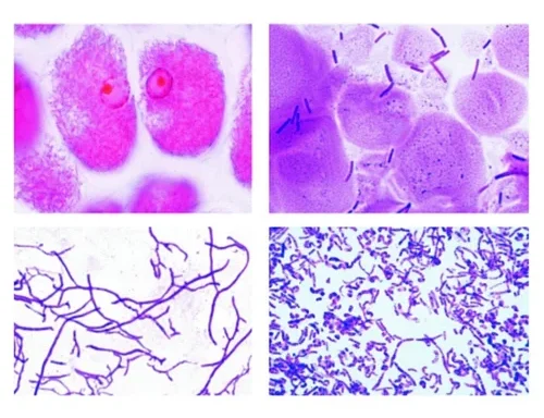 Auxiliary Items Permanent slide of Bacteria (Coccai, Bacillide, Vibrio, Spyre