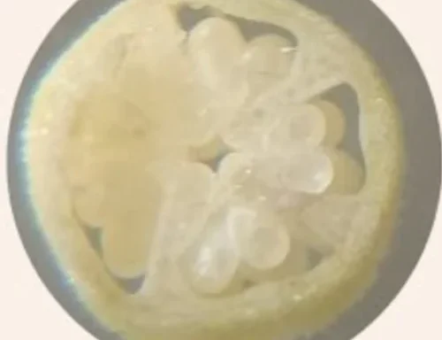 Auxiliary Items Permanent slide of T.S.of Ovule of Hibiscus