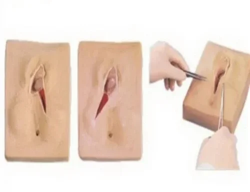 Surgical Suture Model